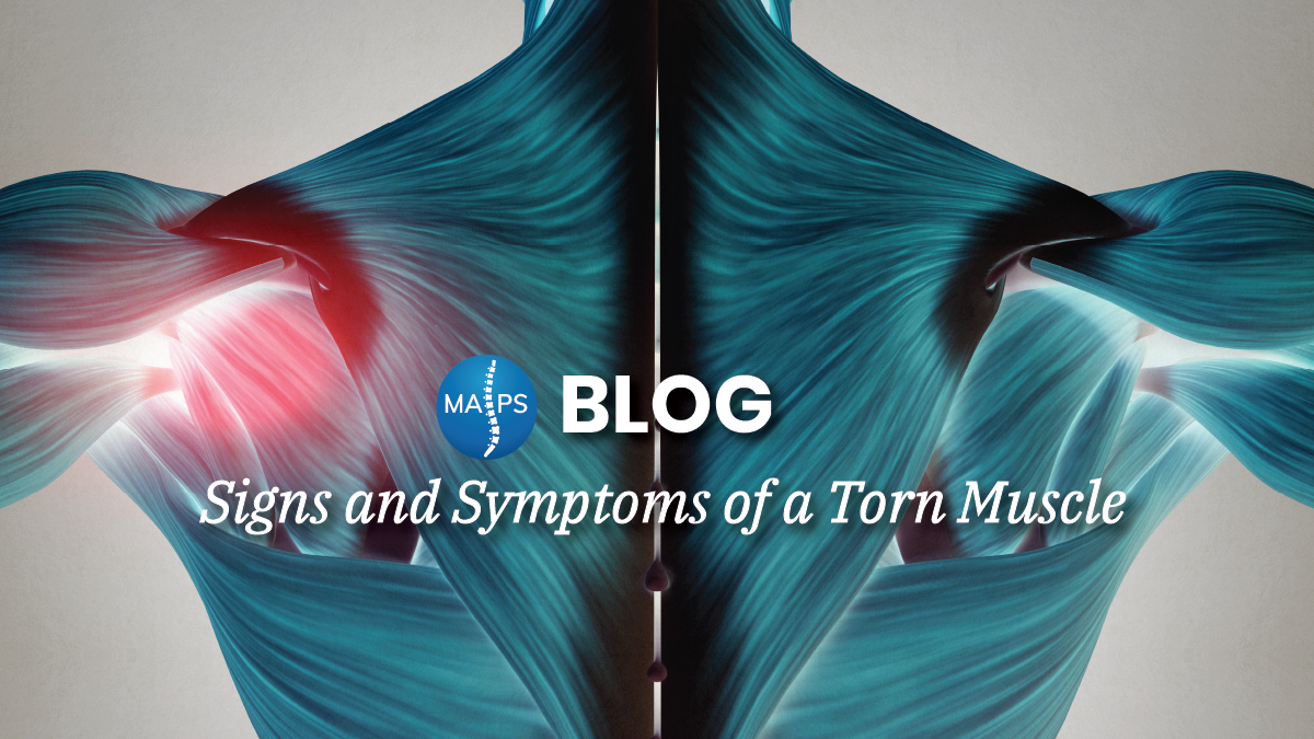 Signs and Symptoms of a Torn Muscle