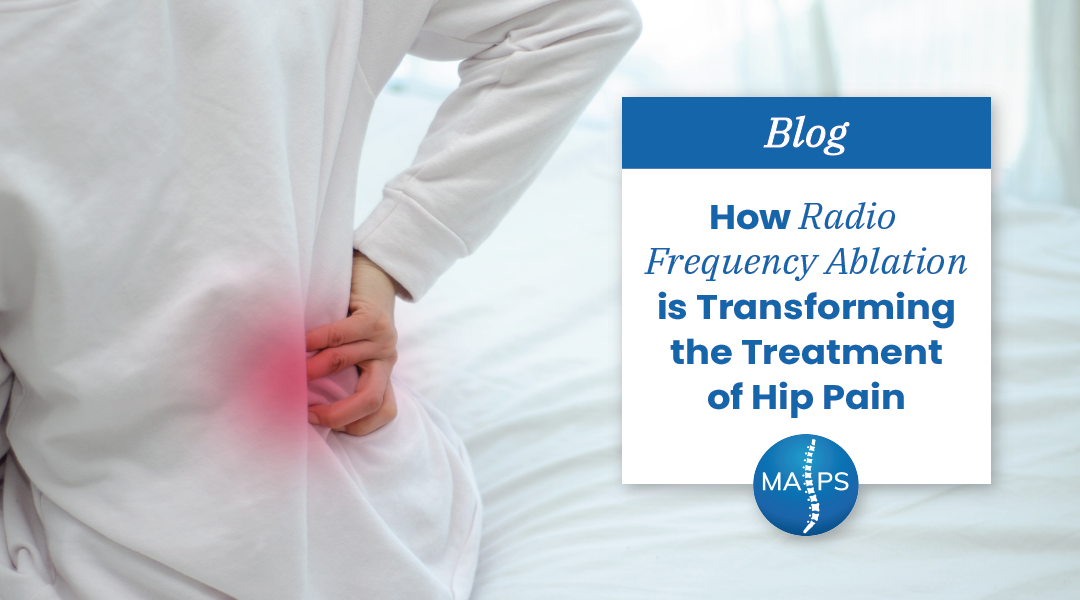 How Radio Frequency Ablation is Transforming the Treatment of Hip Pain