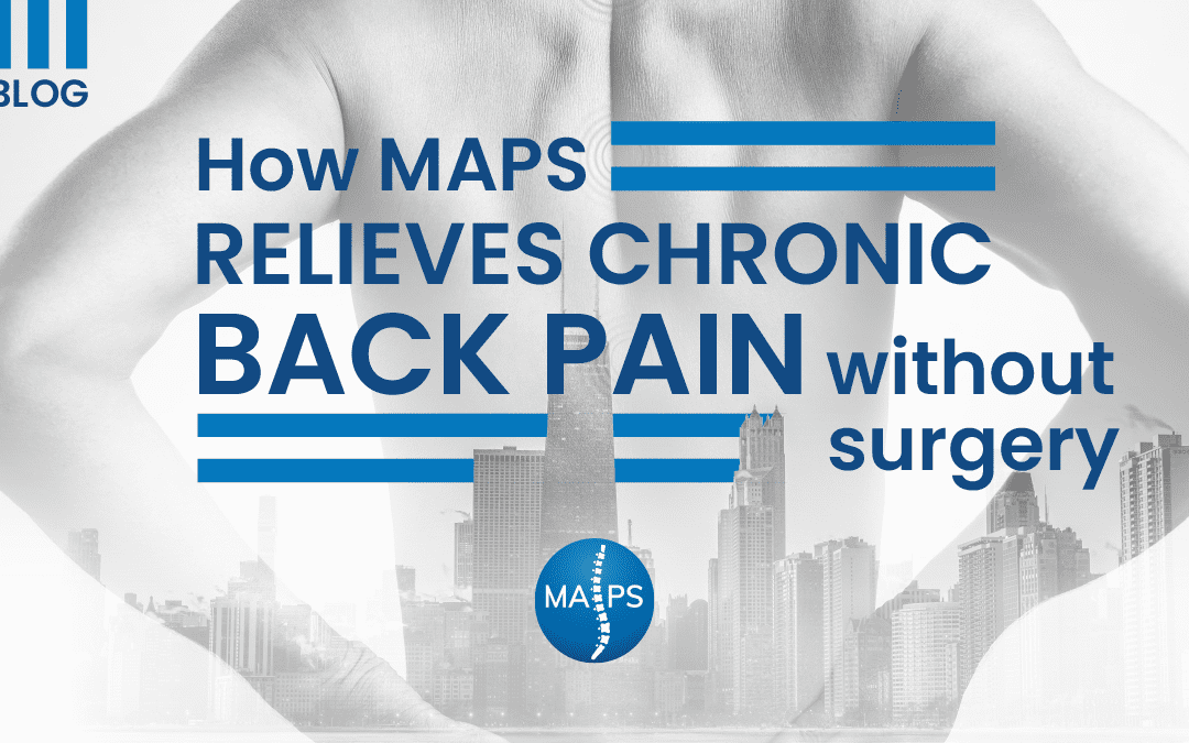 How MAPS Relieves Chronic Back Pain Without Surgery
