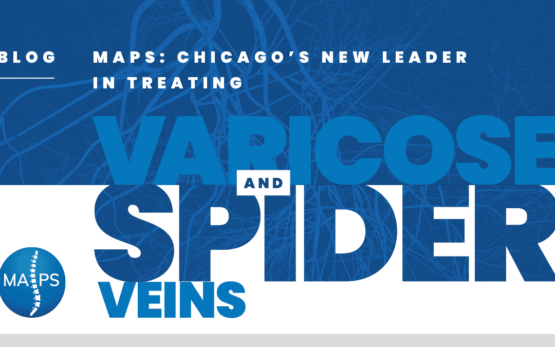 MAPS: Chicago’s New Leader in Treating Varicose and Spider Veins