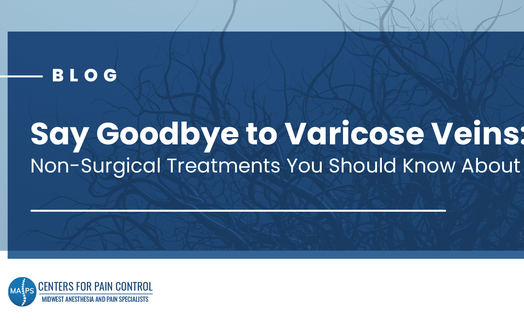 Say Goodbye to Varicose Veins: Non-Surgical Treatments You Should Know About