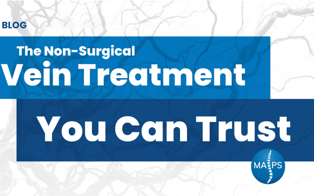 The Non-Surgical Vein Treatment You Can Trust