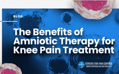 The Benefits of Amniotic Therapy for Knee Pain Treatment