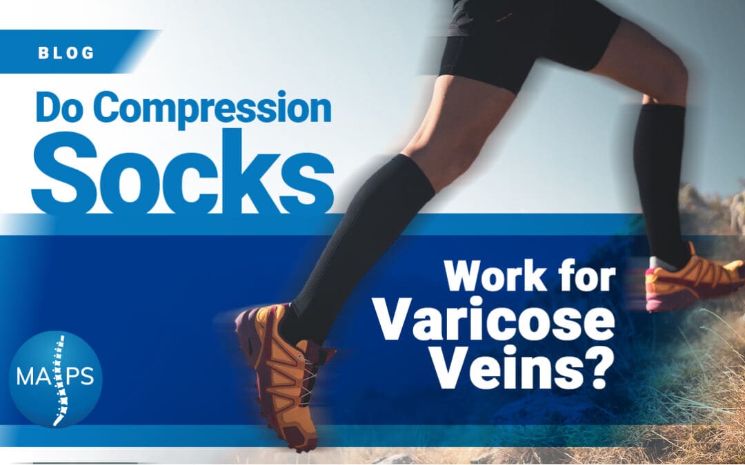 Do Compression Socks Work for Varicose Veins?
