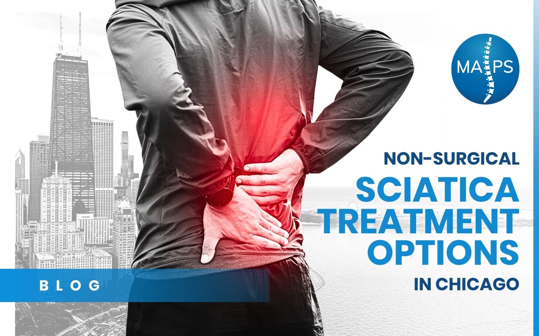 Man holding his lower back with a red pain indicator and the Chicago skyline in the background, illustrating non-surgical sciatica treatment in Chicago