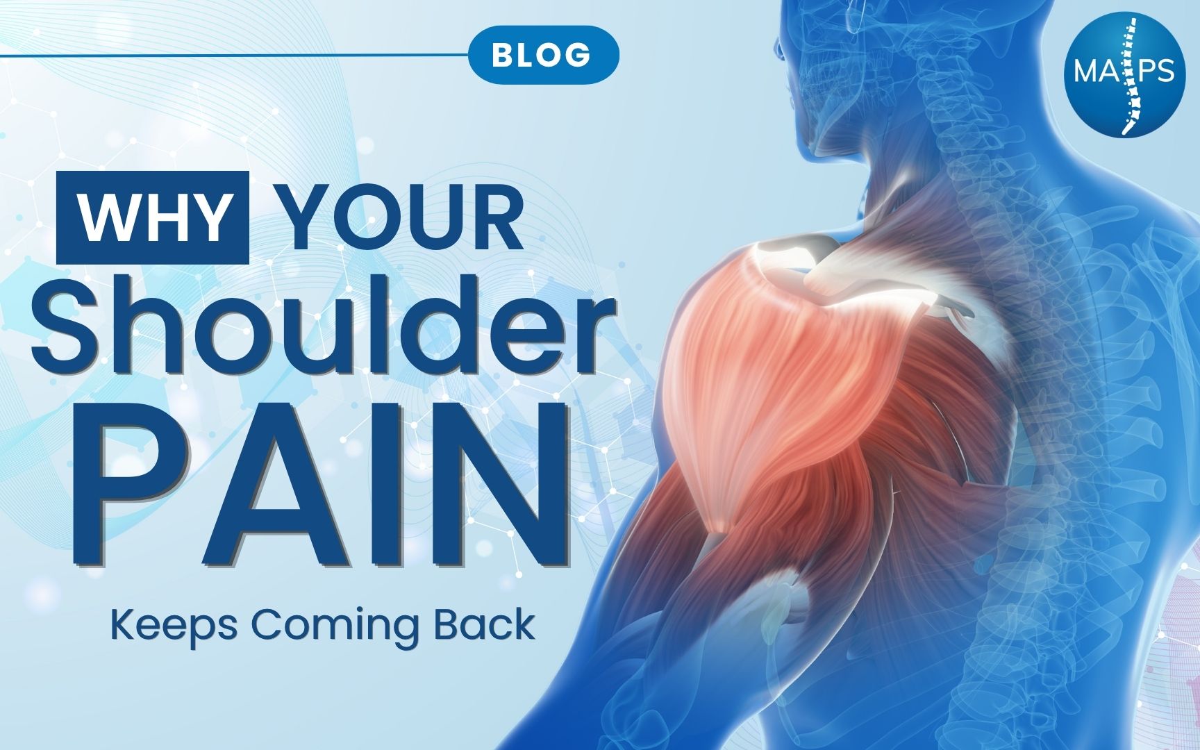 Why Your Shoulder Pain Keeps Coming Back – MAPS 3D medical illustration of shoulder muscles and anatomy highlighted in red and orange against a blue translucent human figure, featured in a MAPS blog post about recurring shoulder pain.