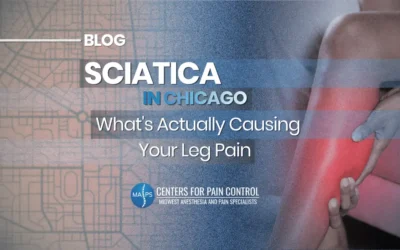Sciatica in Chicago: What’s Actually Causing Your Leg Pain