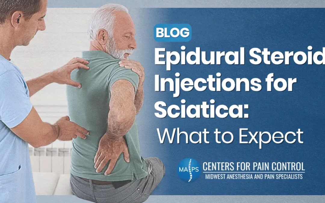 Epidural Steroid Injections for Sciatica: What to Expect