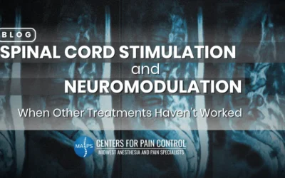 Spinal Cord Stimulation and Neuromodulation: When Other Treatments Haven’t Worked